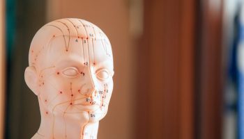 Craniopuntura Chinesa: Microssistema do Escalpo Terapêutico