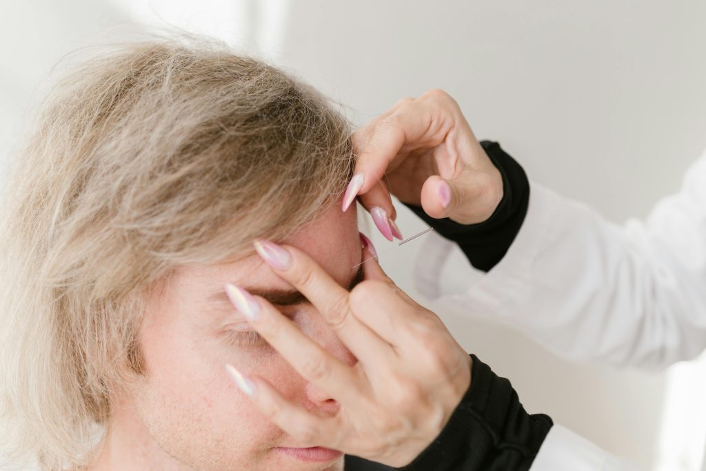 O que é craniopuntura chinesa